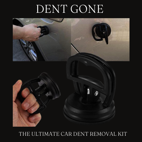 DENT GONE ™