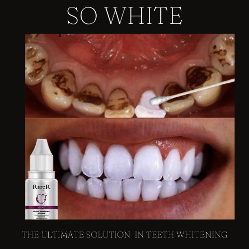 SO WHITE ™